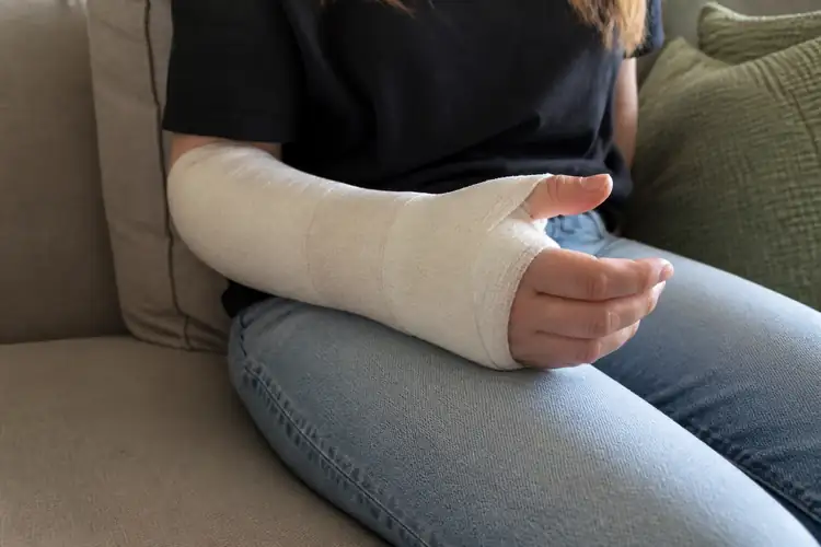 Gipsfase hand en pols
